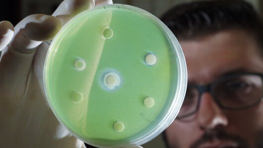 Testing the influence of bacterial extracts on the growth of algae.