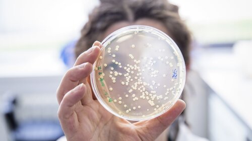 Growth of bacterial colonies.
