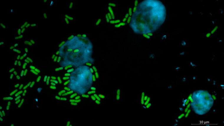 Pseudomonas Bakterien sind giftig für Amöben.