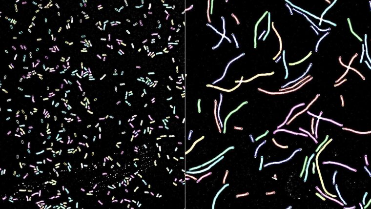 K. pneumoniae in the usual form of short rods (l.) and damaged as long, filamentous bacteria (r.).