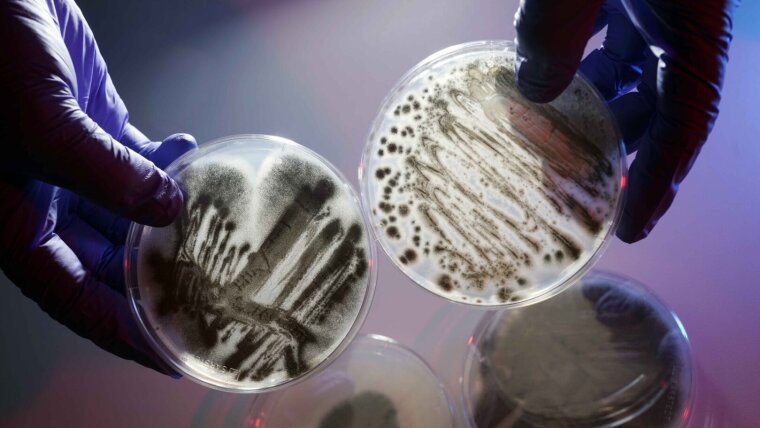 The pathogenic mould Aspergillus fumigatus is one of the infectious agents that the research team wants to combat with the help of non-pathogenic microbes.
