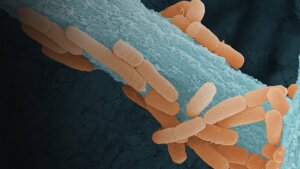 𝘓𝘪𝘨𝘪𝘭𝘢𝘤𝘵𝘰𝘣𝘢𝘤𝘪𝘭𝘭𝘶𝘴 𝘮𝘶𝘳𝘪𝘯𝘶𝘴 (orange) wächst entlang der Hyphen des pathogenen Pilzes 𝘈𝘴𝘱𝘦𝘳𝘨𝘪𝘭𝘭𝘶𝘴 𝘧𝘶𝘮𝘪𝘨𝘢𝘵𝘶𝘴 (blau).
