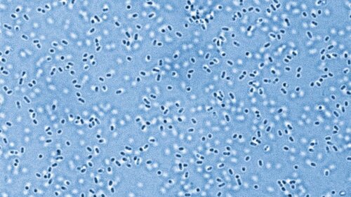 Blue-colored electron microscope image of Pandoraea sputorum, a pathogen from the lung microbiome that has been little studied to date.