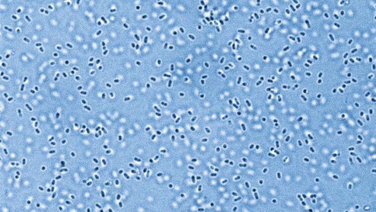 Elektronenmikroskopische Aufnahme von Pandoraea sputorum, einem bislang wenig erforschten pathogenen Bakterium aus dem Lungenmikrobiom.