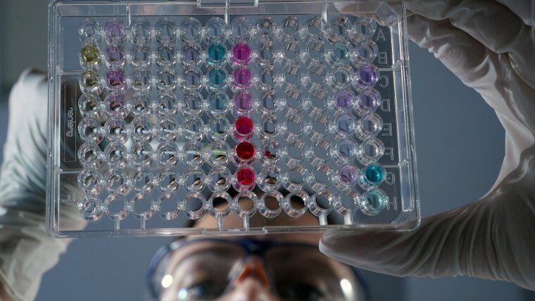 mit einer Pipette werden Zellproben in eine sogenannte Mikrotiterplatte eingebracht