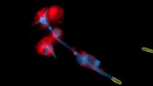 Durch die Bildung von langen fadenähnlichen Hyphen, bricht der Hefepilz Candida albicans (blau) aus menschlichen Immunzellen (rot) aus. In gelb der Teil der Hyphe, der die Zellen bereits verlassen hat.