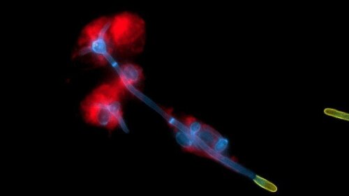 Durch die Bildung von langen fadenähnlichen Hyphen, bricht der Hefepilz Candida albicans (blau) aus menschlichen Immunzellen (rot) aus. In gelb der Teil der Hyphe, der die Zellen bereits verlassen hat.