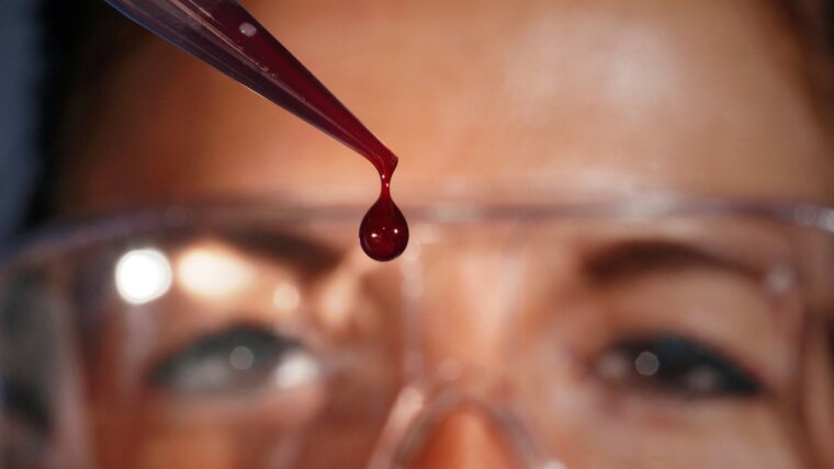 Student drops blood into a sample container with a pipette