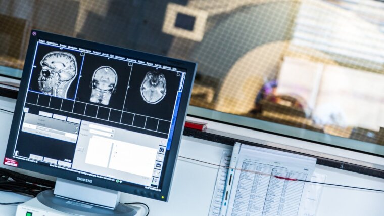 MRI scan