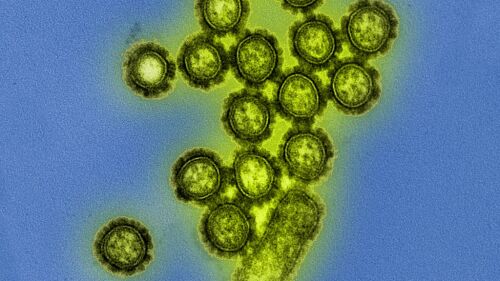 H1N1 Influenza virus.