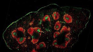 Fluorescence-microscopic capture of germinal centers, in which B cells mature after infection.