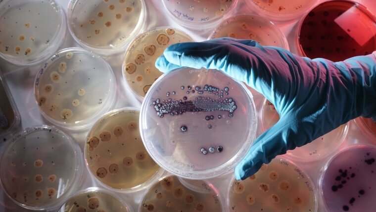 Microbial cultures in Petri dishes, front: Streptomyces lividans