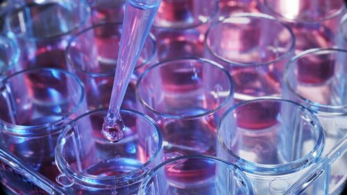 Cell samples are pipetted into a microtiter plate