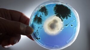 fungal culture in petri dish