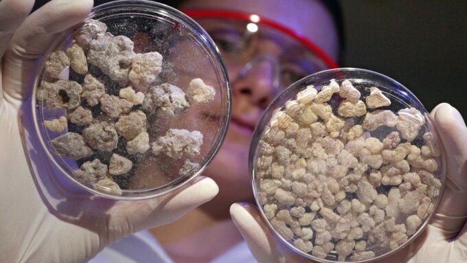 Frankincense resin from Africa (l.) and India. Extracts of this resin can reduce inflammation.