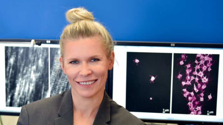 Izabela Firkowska-Boden vor Bildschirmen, die nanostrukturierte Oberflächen und Thrombozyten zeigen.
