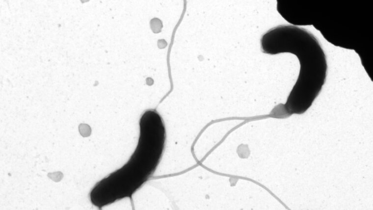 Cholera bacteria under the microscope.