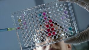 Eine Chemikerin im SFB Polytarget bringt mit einer Pipette Zellproben in eine Mikrotiterplatte ein.
