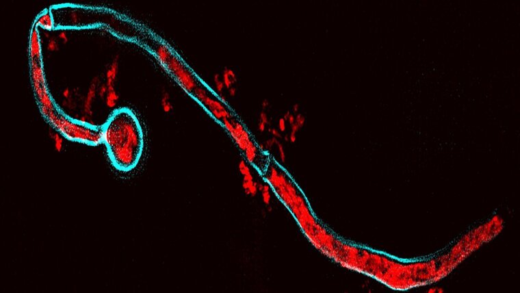 Candida albicans (blue) takes up human microRNA (red) from extracellular vesicles.