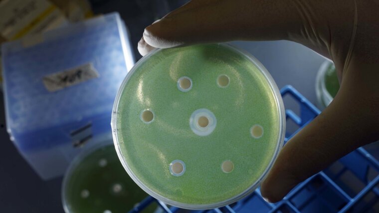 Petri dish with an algae culture into which bacterial extracts were introduced.