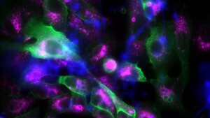 Das fluoreszenzmikroskopische Bild zeigt Epithelzellen (große, unregelmäßige Strukturen) und Pilzsporen (kleine, kugelige Strukturen). Sind die Pilzsporen von p11 umgeben, erscheinen sie grün. Die violette Fluoreszenzfarbe markiert hingegen ein Protein in gereiften Phagosomen.
