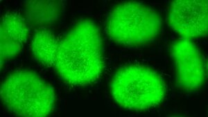 Ein Aspergillus nidulans-Reporterstamm, der grün fluoreszierendes Protein (GFP) produziert.