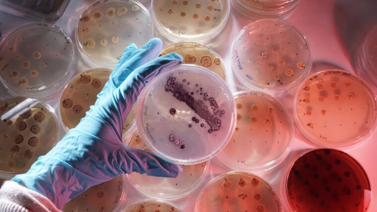 Bacteria cultures in Petri dishes.