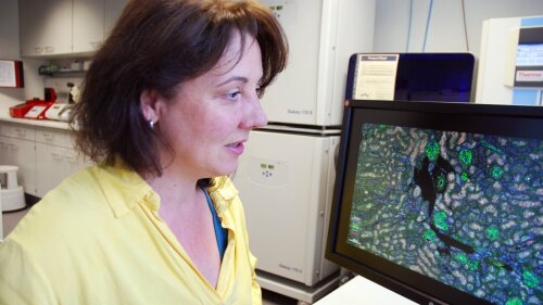 PD Dr. Ivonne Löffler untersucht geschlechtsspezifische Unterschiede der Alterung im Nierengewebe.