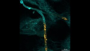 Der Pilz Candida albicans (blaue Färbung) dringt in eine menschliche Epithelzelle ein und produziert dabei das Toxin Candidalysin (gelbe Färbung).