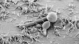 Candida albicans in der Hefe- und Hyphenform auf menschlichen Epithelzellen.